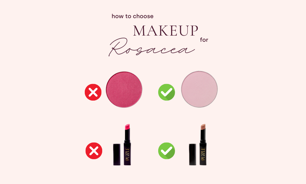 How to Choose Makeup for Rosacea