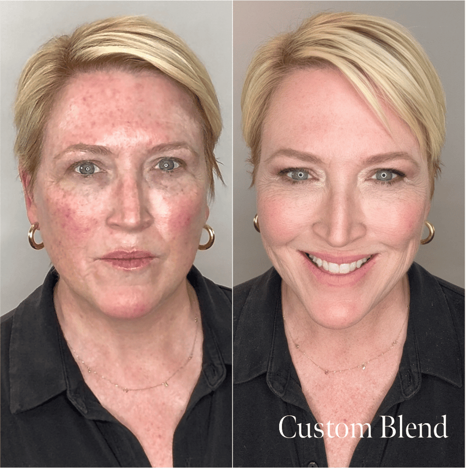 The Overachiever For Rosacea | Puzzle Makeup