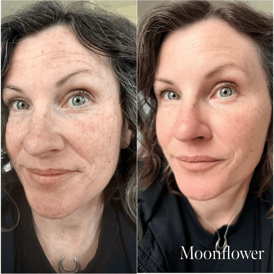 The Overachiever For Rosacea | Puzzle Makeup